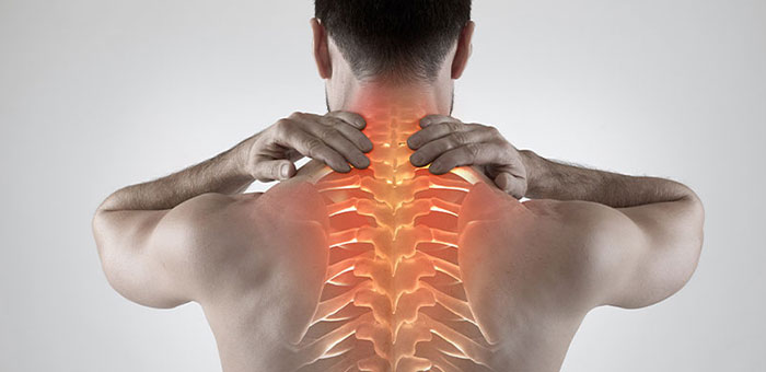 Man with upper back pain before chiropractic treatment from Cleveland chiropractor